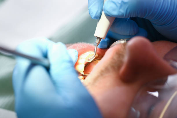 Best Pediatric Emergency Dentist in Mclean, TX
