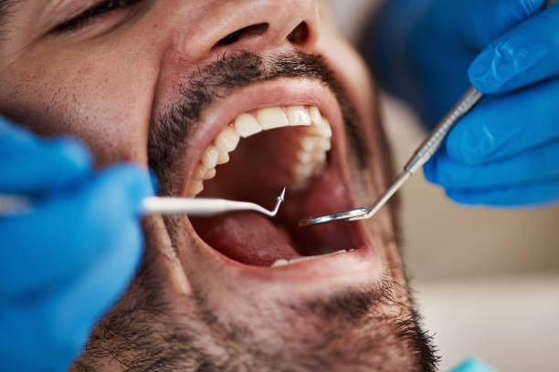 Best Mobile Emergency Dentist in Mclean, TX